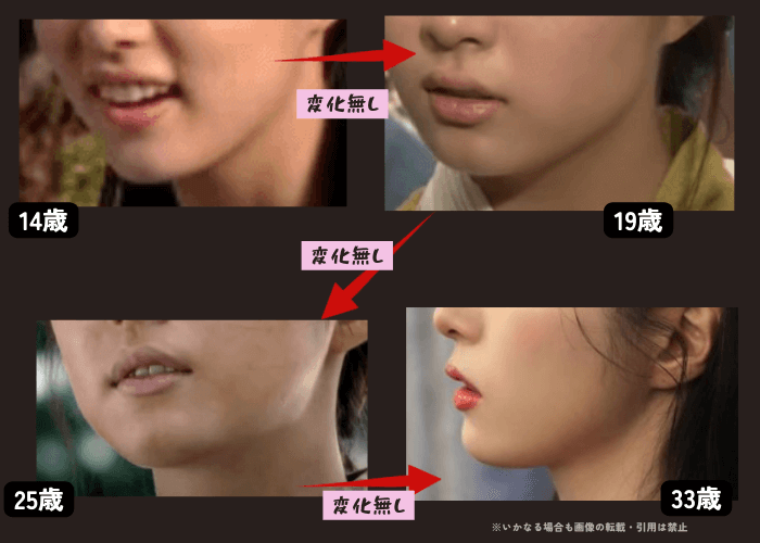 韓国女優シンセギョンの唇の変化について時系列検証画像
以下4枚の画像

14歳（左上画像）
19歳（右上画像）
25歳（左下画像）
33歳（右下画像）

時系列で確認しても、あごの形に変化が無いことがわかる